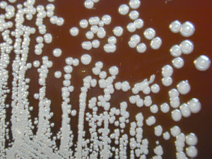 Bacteria that cause melioidosis as seen under a microscope. Photo source: CDC Public Health Image Library